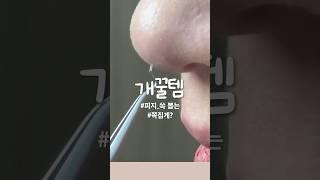 3초만에 #피지제거 성공될까?