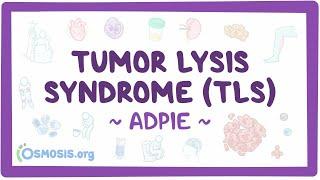 Tumor lysis syndrome (TLS): Nursing Process (ADPIE)