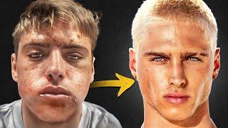 The Best Glow-Up I've Seen in Real Life (Interview with him)