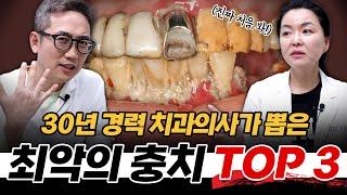 치과의사가 뽑은 역대급 충치 환자 Top 3!!