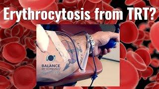 Erythrocytosis From TRT - How to Manage Increased Red Blood Cells and Hematocrit Due to TRT