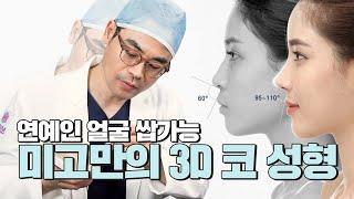 연예인 얼굴 쌉가능! 미고만의 3D 코 성형