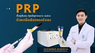 PRP ฟื้นฟูเส้นผม หยุดปัญหาผมบาง ผมร่วง ด้วยเกล็ดเลือดของตัวเอง