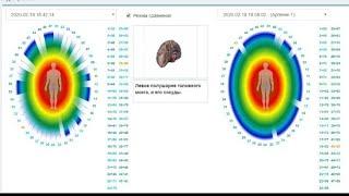 * КОМПЬЮТЕРНАЯ ДИАГНОСТИКА ВСЕГО ОРГАНИЗМА -БРТ за 5 -10 мин