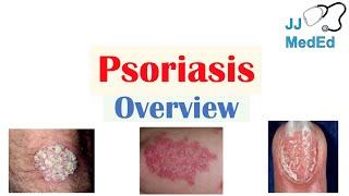 Overview of Psoriasis | What Causes It? What Makes It Worse? | Subtypes and Treatment