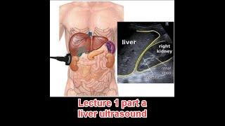 Abdominal ultrasound course :  lecture 1 part a ( liver) د عمرو صلاح