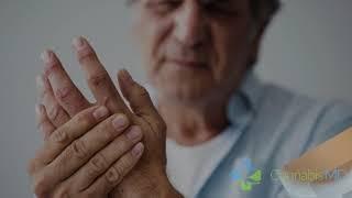CBD for Arthritis - March