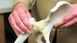 Hip Pain, Hip Replacement Springfield Dr. Ludwig Orthopedic Center of Illinois OCI hip surgery