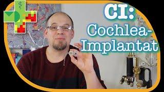 Cochlea-Implantat (CI): So funktioniert das implantierbare Hörsystem