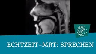 Echtzeit-MRT-Film: Sprechen