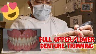 COMPLETE DENTURE TRIMMING | FULL UPPER AND LOWER DENTURES | THE DENTAL TECHNICIAN'S DIARY