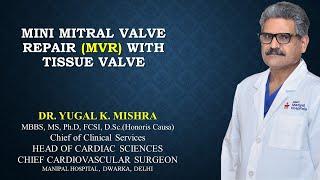 Mini Mitral Valve Repair (MVR) with Tissue Valve by Dr Yugal Mishra, Manipal Hospital, Dwarka