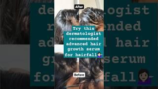 I Tried a Dermatologist-Recommended Hair Growth Serum #shortsfeed #shorts #ytshorts #hairgrowth