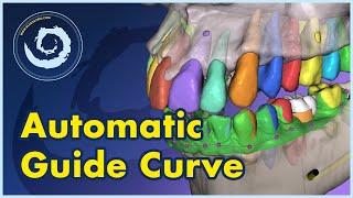 BSP V4.13: Automatic Surgical Guide Curve: The Future of Surgical Guides is Here!