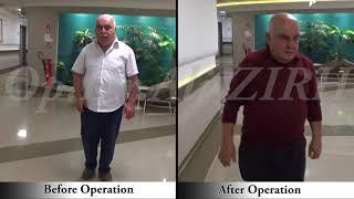 Yasar SAHIN / Before and After Surgery Parkinson's Treatment DBS in Turkey