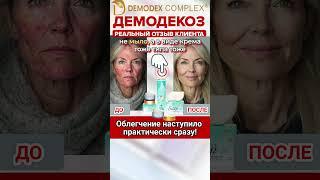 РЕАЛЬНЫЙ ОТЗЫВ: "Помогло с ПЕРВОГО применения!" | Кожа стала ИДЕАЛЬНОЙ  #демодекоз #демодекслечение