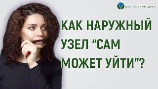 НАРУЖНЫЙ ГЕМОРРОЙ. Как наружный узел "сам может уйти"