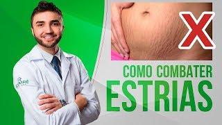 COMO COMBATER AS ESTRIAS! - NA BARRIGA, SEIOS E BUMBUM - DR LUCAS FUSTINONI - MÉDICO