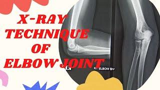 Technique of Elbow joint (Ep-58) | x-ray elbow joint ap & lateral view |