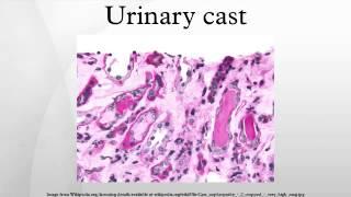 Urinary cast