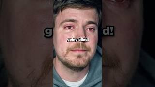 We Saved MrBeast From Going BLIND 