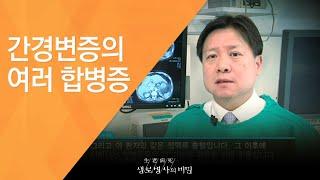 간경변증의 여러 합병증 - (2011.2.12_361회 방송)_당신의 간이 굳어간다 침묵의 질환, 간경화!