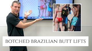 Botched Brazilian Butt Lifts | Dr. Barrett Breaks Down Terrible Plastic Surgery Results