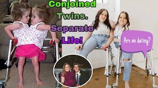 Conjoined Twins Kendra & Maliyah's Update! Life Now.