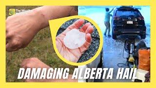 Homeowner Injured In Calgary's Destructive Hailstorm