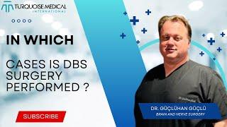 In which cases is DBS surgery performed ? - Brain And Nerve Surgery