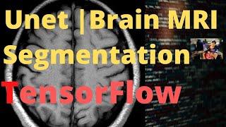 Unet Brain-MRI-Segmentation | TensorFlow | Computer Vision | Deep Learning | Kaggle | Medical Image