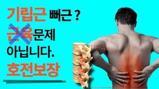 기립근이 당기고 뻐근할 때 필수시청!!