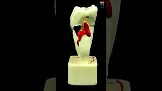 iDENTical 4X Pathologies of Tooth Model M4015 - Dental Anatomy Learning Tool #shorts #shortsvideo