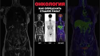 Как найти ПЕРВИЧНУЮ ОПУХОЛЬ и ОТДАЛЕННЫЕ МЕТАСТАЗЫ? #меднавигатор #рак #онкология