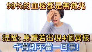 99%的血栓無徵兆！提醒：身體若出現這4個異樣，千萬別不當一回事