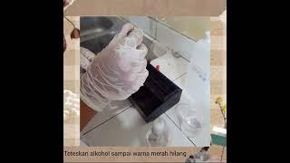 pemeriksaan mikroskopis sputum