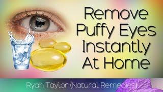 How To Remove Puffy Eyes Instantly (Natural Remedies)