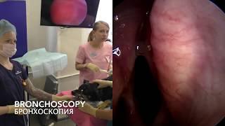 Laryngotracheoscopy, BAL/Ларинготрахеоскопия, бронхоальвеолярный лаваж