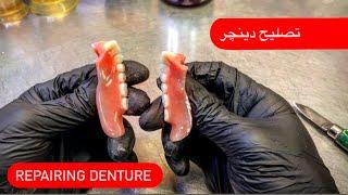 FIXING A BROKEN DENTURE (No stitches) تصليح بدلة دينچر مكسورة #WAXBAE #REPAIRS #DENTURES