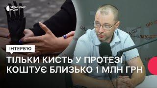 Безкоштовне протезування в Україні: хто має право та які протези кращі?