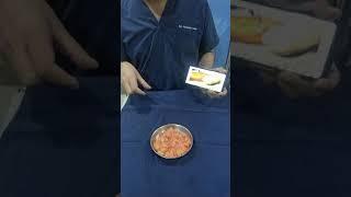 Lipoma Removal Delhi !! Dr. Prashant Yadav