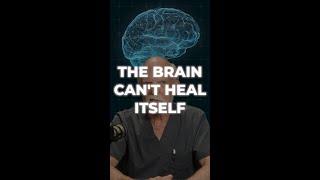 Brain Healing Myth