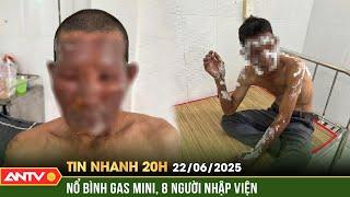Nổ bình gas mini trong đám giỗ, 8 người nhập viện | Tin nhanh 20h ngày 22/6 | ANTV