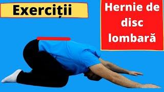 Exerciții de kinetoterapie pentru hernia de disc lombară - Ședința 2