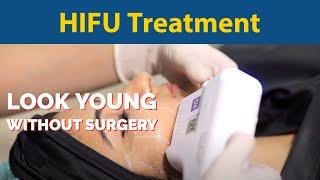 Hifu Treatment - Look young without surgery | HIFU Skin Tightening Procedure | Dr. Jyoti Gupta MD