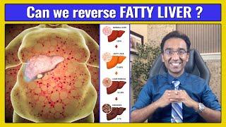 Fatty Liver - Do NOT Ignore | Dr Pal