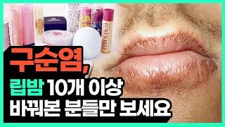 구순염 립밤 립스틱 아무리 바꿔도 입술 각질, 진물, 가려움증 안 낫는 이유? 구순염 원인과 치료방법을 제대로 알아야 합니다.