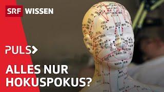 Umstrittene Komplementärmedizin: Hokuspokus oder heilsame Ergänzung? | Puls | SRF Wissen