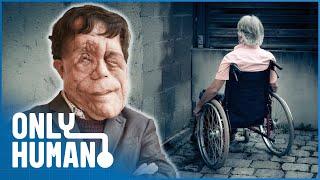 The Ugly Face of Disability Hate Crime: Adam Pearson Investigates