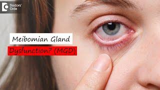 Meibomian Gland Dysfunction (MGD) & How it is corrected? - Dr. Sunita Rana Agarwal | Doctors' Circle